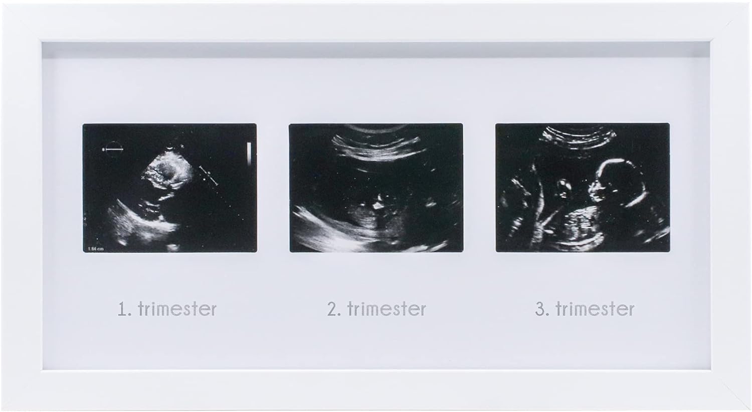 Üçlü Ultrason Anı Çerçevesi - Gebelikte Bebeğin Gelişimini Üç Trimester Anı Olarak Saklayın