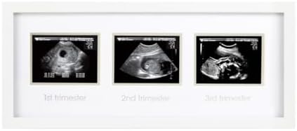 87038 Trimester Sonogram Frame Deluxe, fotoğraf çerçevesi için üç Ultraschallaufnahmen, beyaz