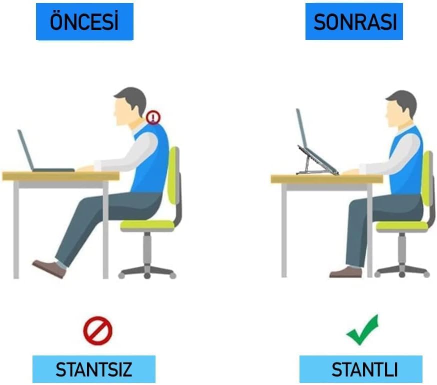 ® Alüminyum Laptop Standı – 7 Kademeli Yükseklik Ayarı, 15.6 inç’e Kadar Notebook/Tablet Uyumlu, Katlanabilir & Taşınabilir Ergonomik Tutucu