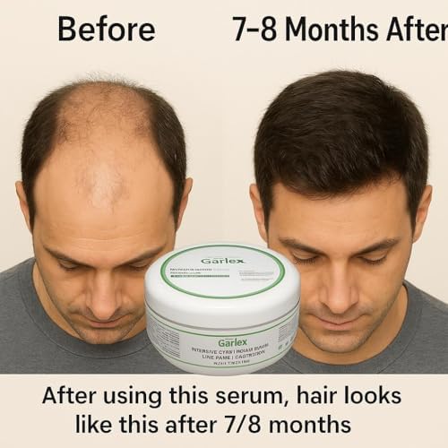 Garlex Yoğun Bakımlı,zengin içerikli, Saç Maskesi 250ml