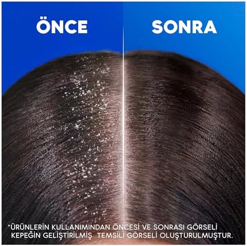 Head & Shoulders İpeksi Yumuşaklık 2'si 1 Arada Kepek Karşıtı 330ML Şampuan